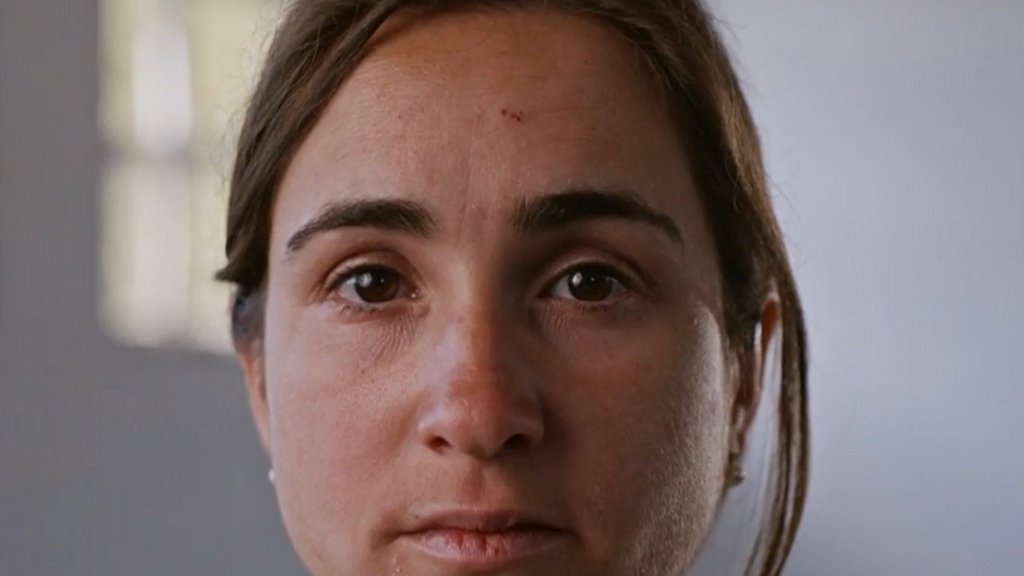 afectados piel atópica