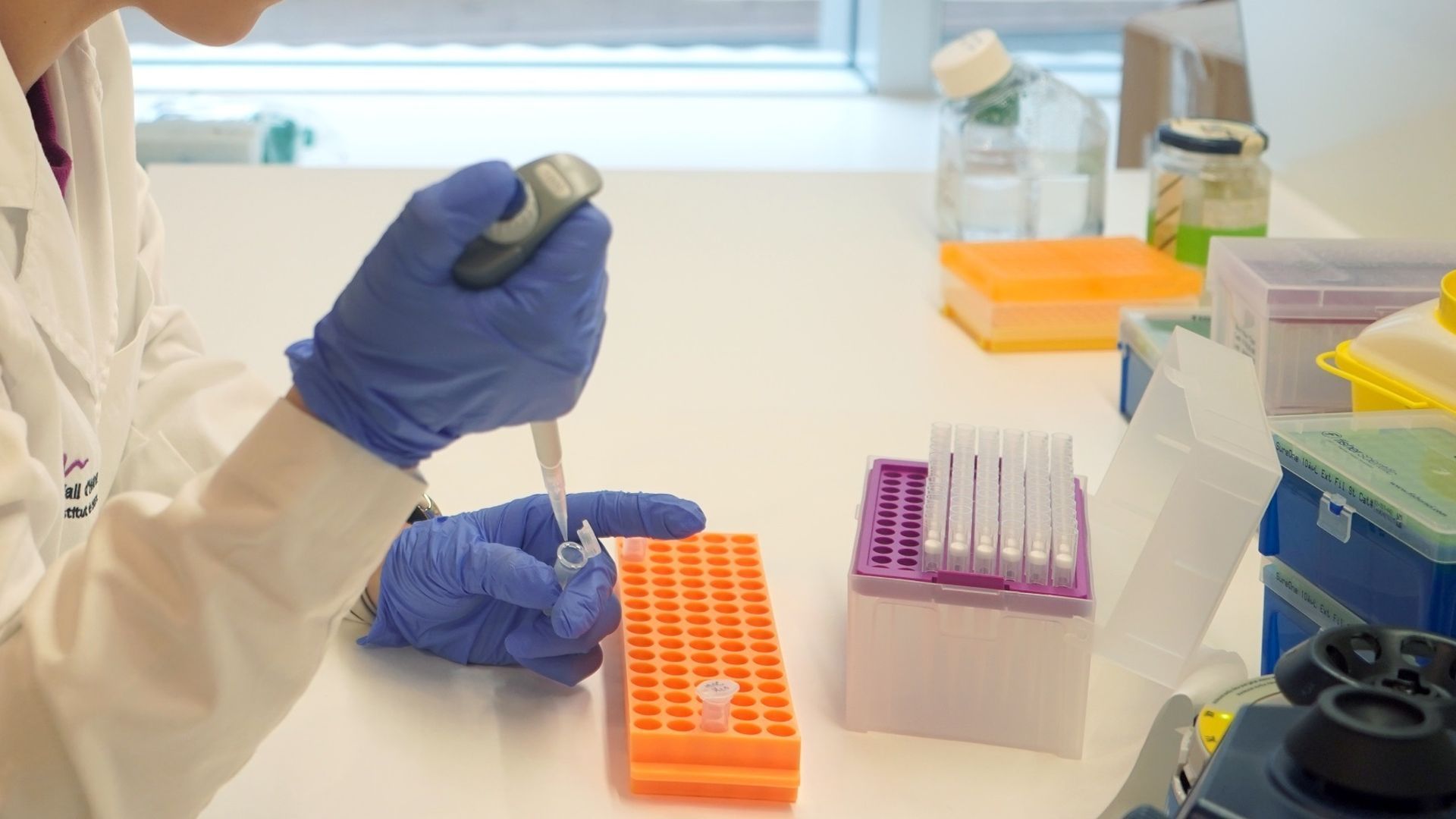 Identifican marcadores para anticipar el diagnóstico de cáncer en personas con VIH