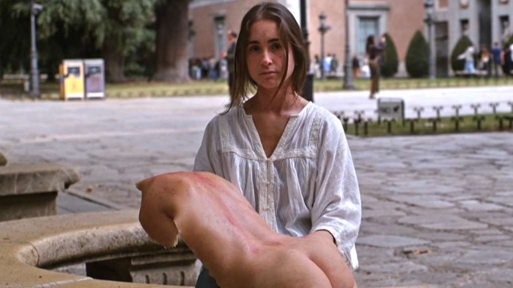 El calvario de vivir con dermatitis atópica: "A veces desearía poder arrancarme la piel”