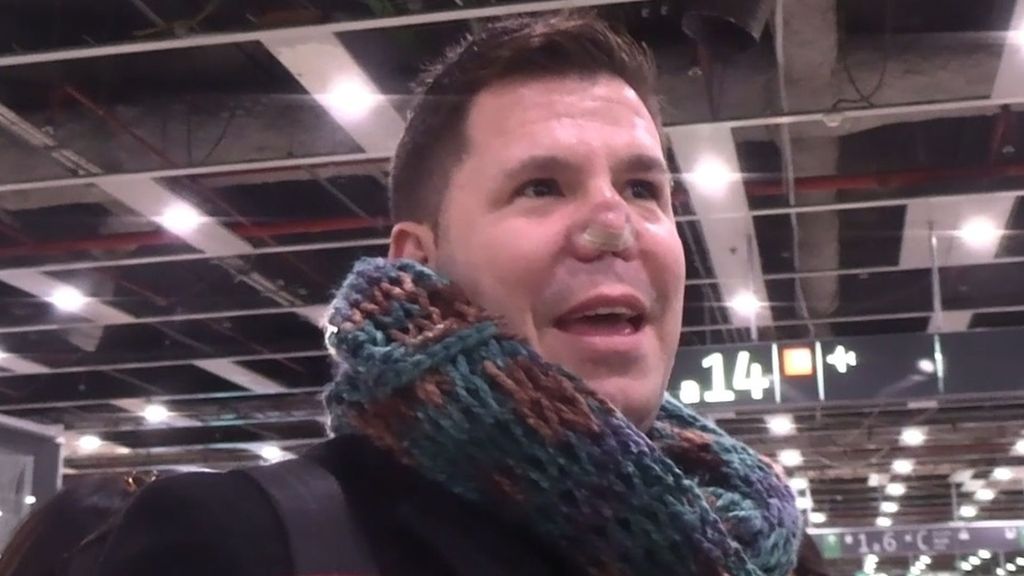 Lucas, de Andy y Lucas, visita al médico por su operación de nariz