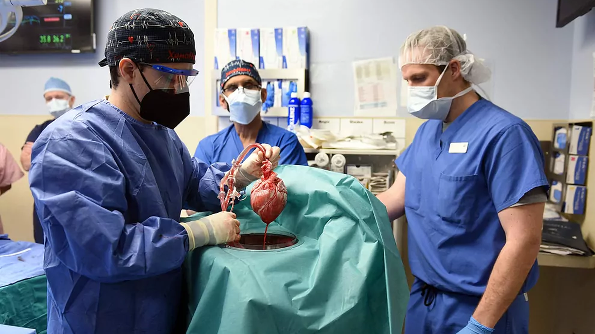 Primer trasplante de corazón de un cerdo genéticamente modificado a un paciente vivo, en 2022