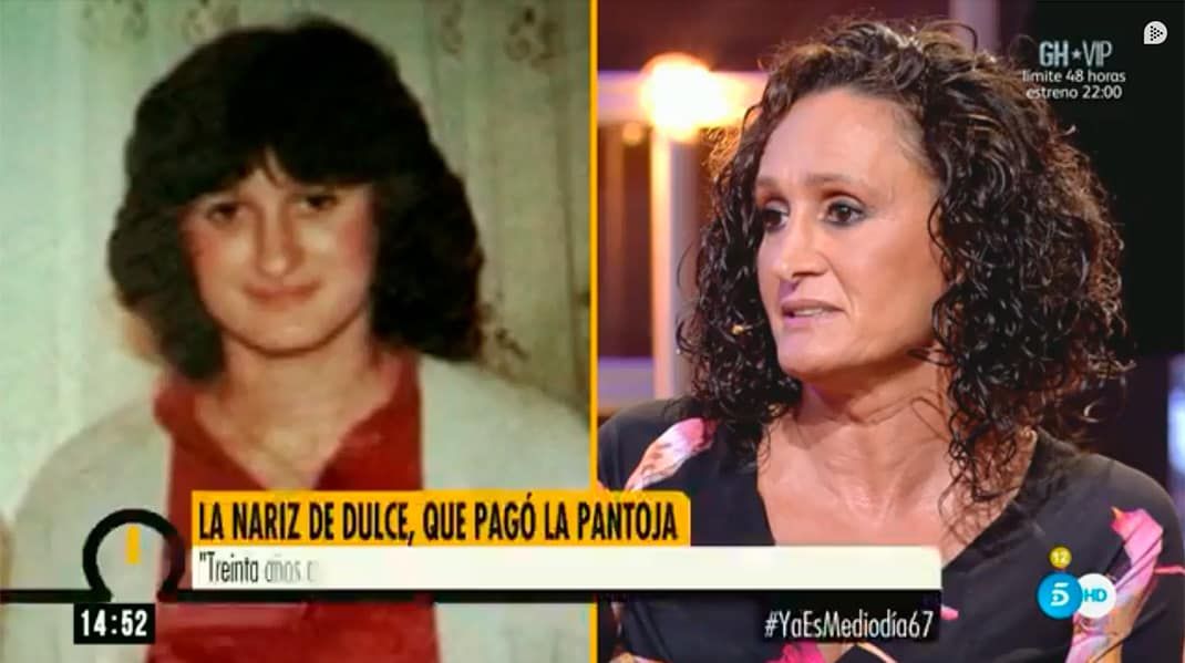 Dulce con su antigua nariz y con su rostro actual