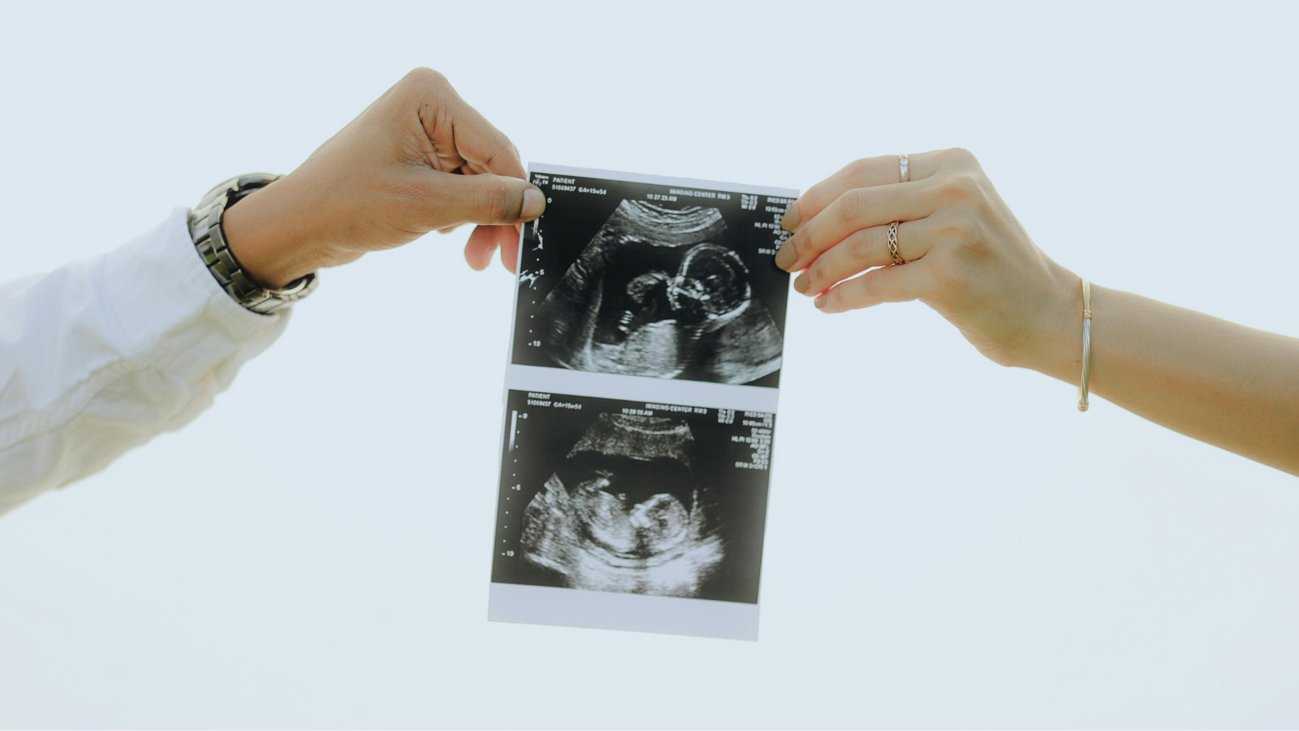 Imagen de una ecografía