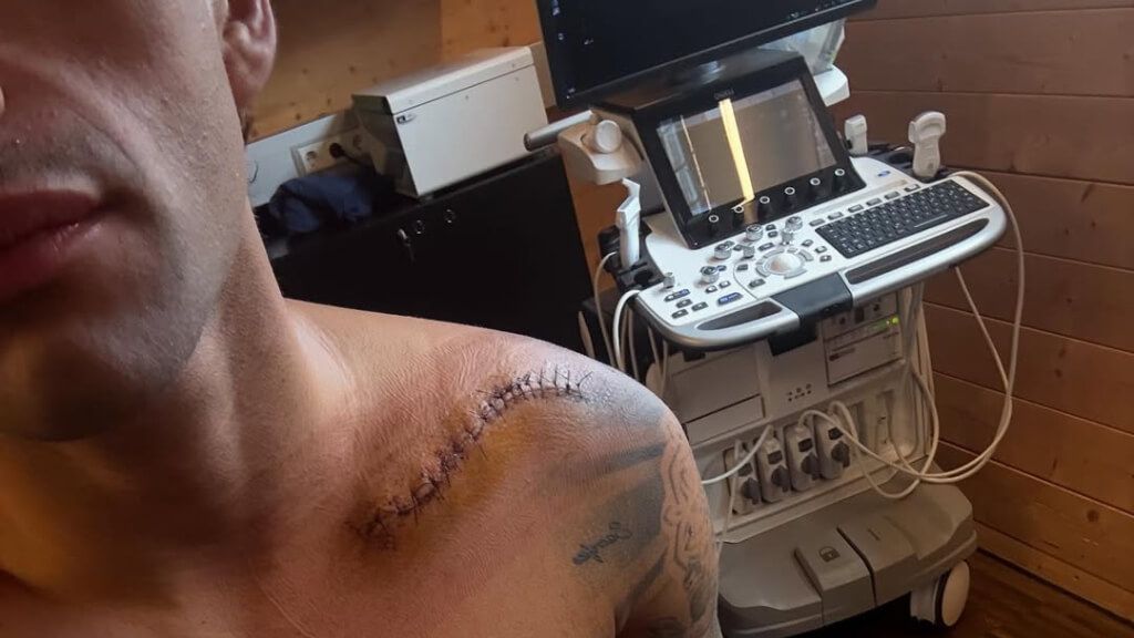  Jorge Martín, durante su recuperación.