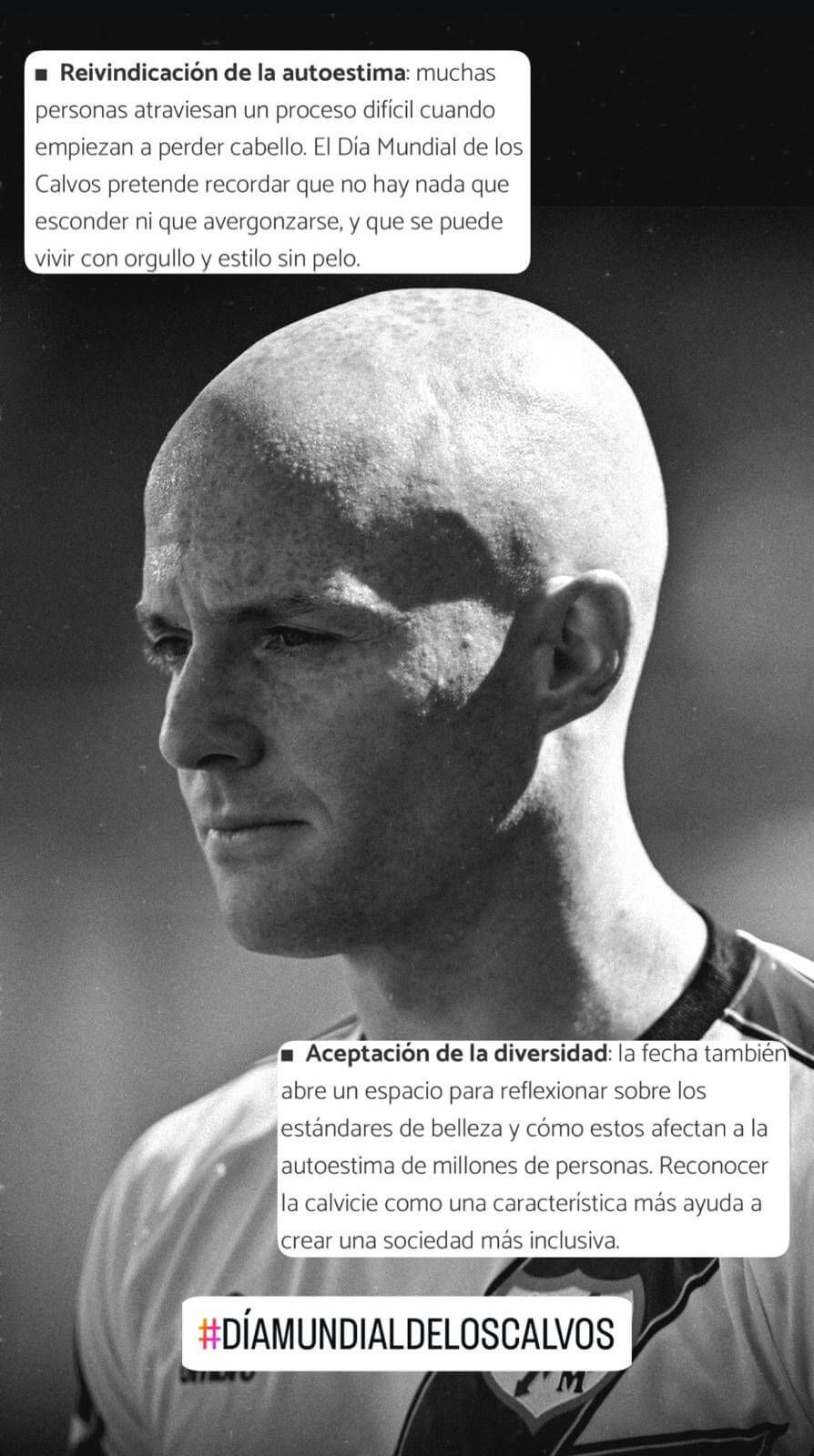  Isi Palazón y su mensaje en El Día Mundial de los Calvos (Instagram)
