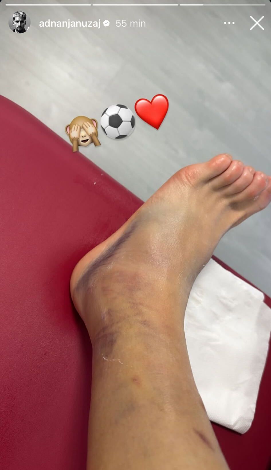  El tobillo de Adnan Januzaj tras el Sevilla - Barça.