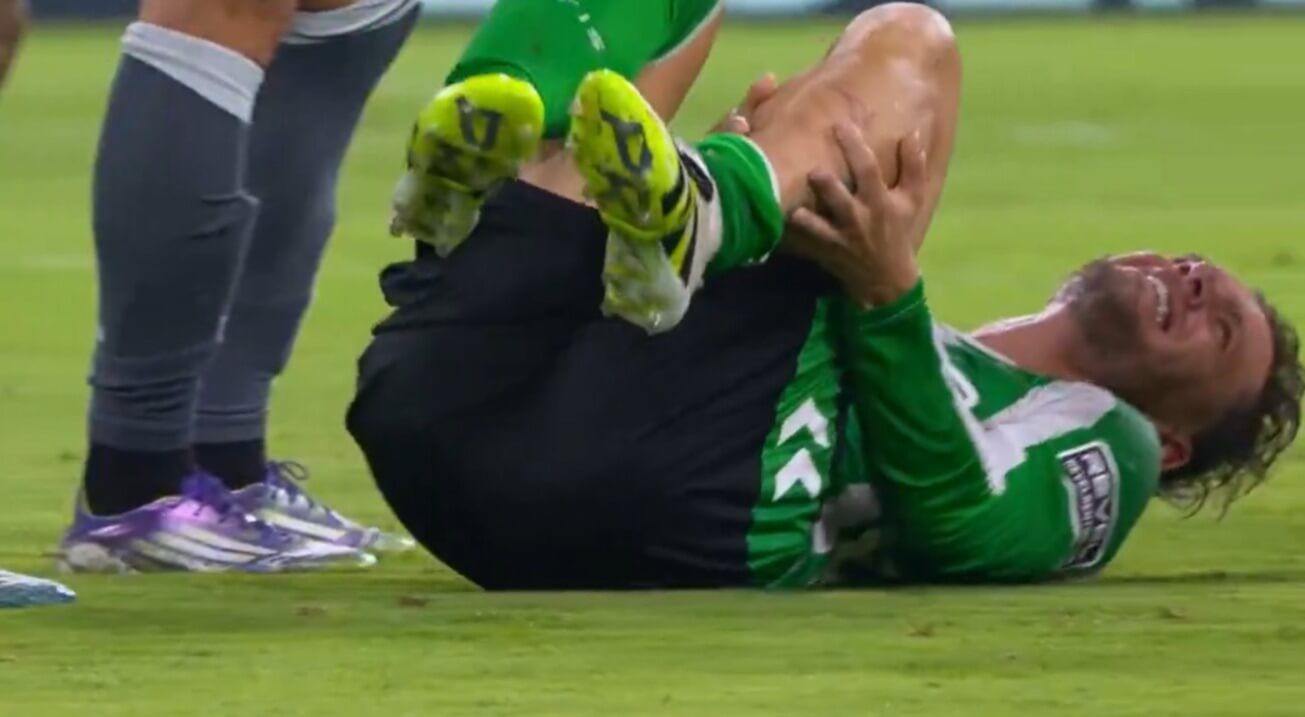  La marca de los tacos en la pierna izquierda de Lo Celso.