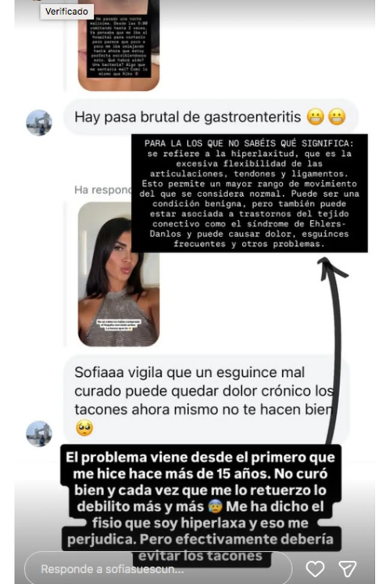 Sofía Suescun habla de su problema con el tobillo