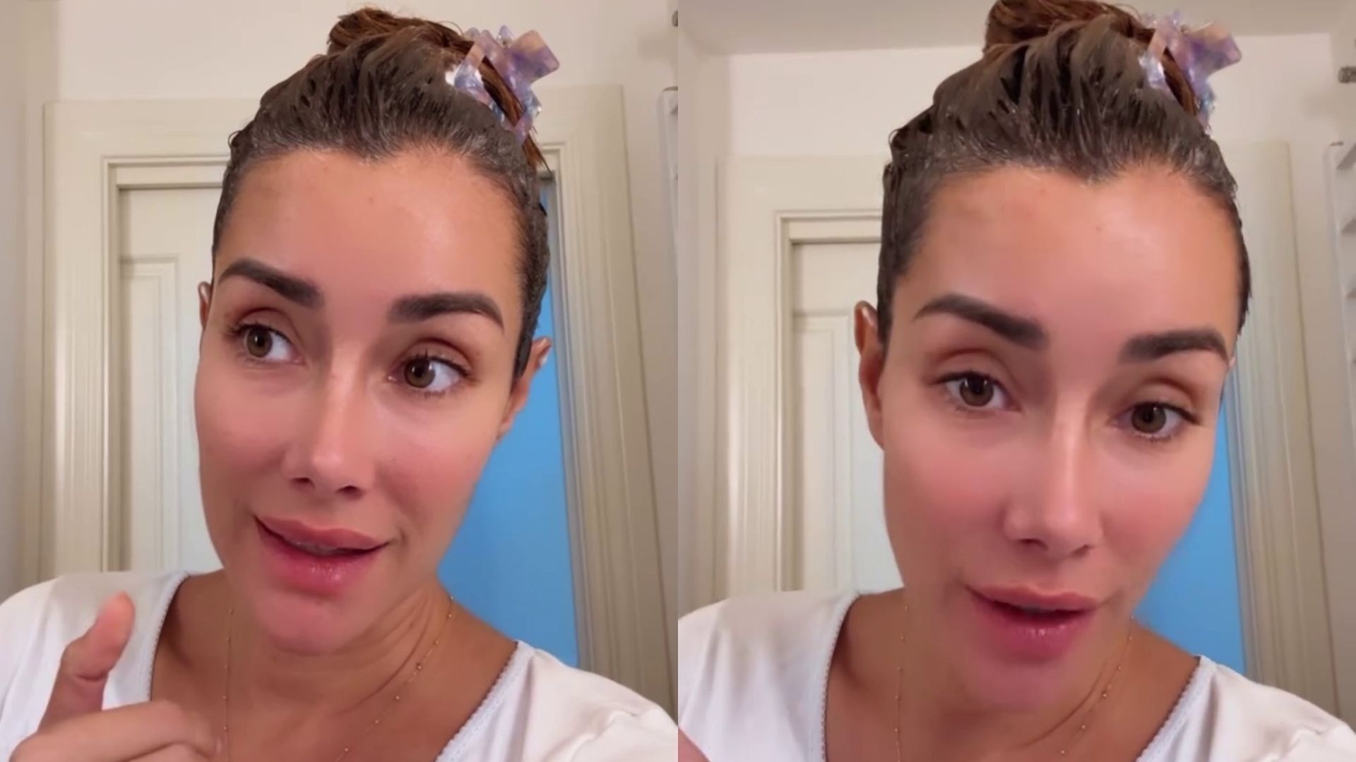 Adara Molinero, con una loción especial por sus piojos