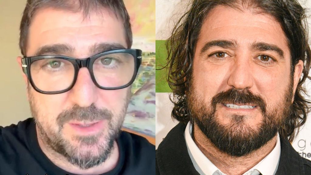 Antonio Orozco, antes y después