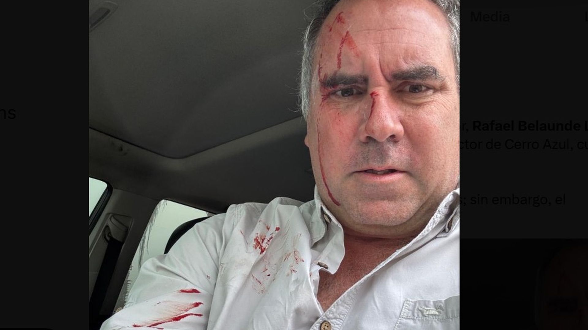 Candidato presidencial de Perú sobrevive a un atentado tras ser tiroteado en su vehículo