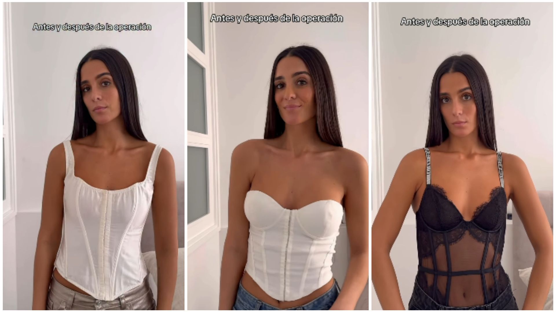 Claudia Martínez posa luciendo pecho un año después de su operación