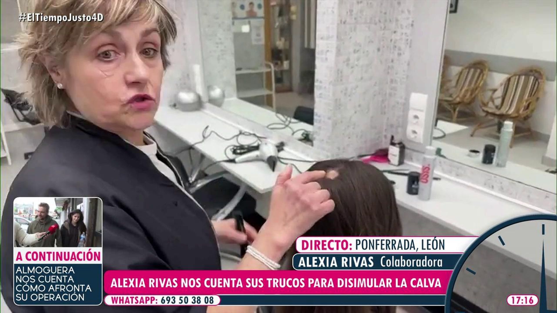 Alexia da tips para disimular las calvas de la alopecia areata que sufre