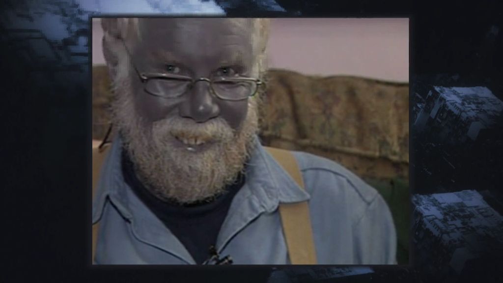 Por qué hay gente con la piel de color azul