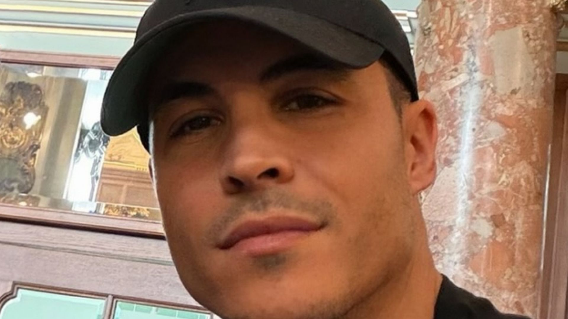 Kiko Jiménez enseña los efectos secundarios tras sufrir shock loss después del injerto