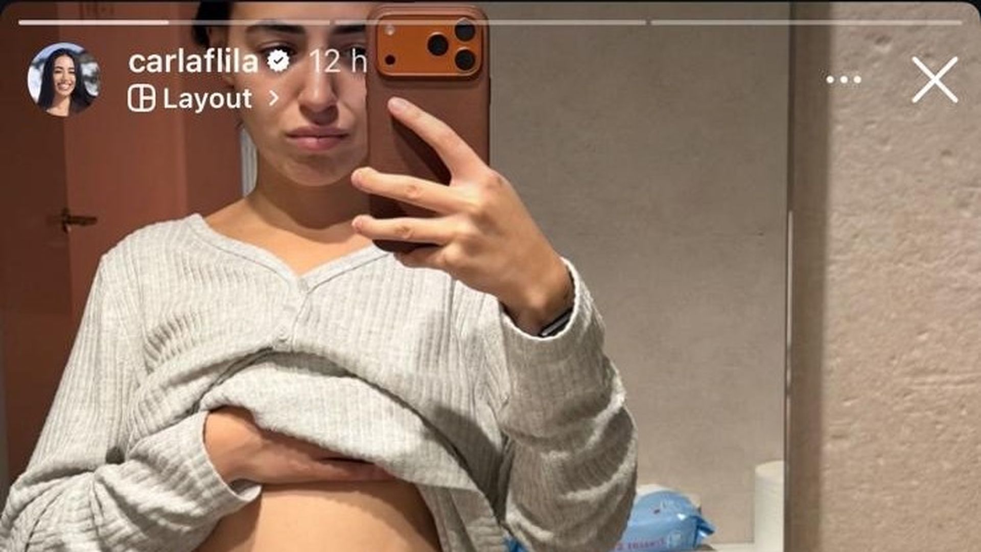 Carla Flila enseña la realidad de su cuerpo