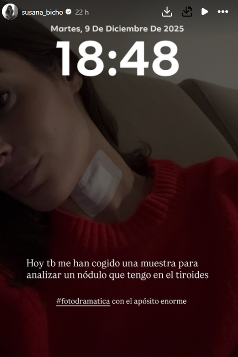 Susana Molina ha contado que le han cogido una muestra para analizar un nódulo