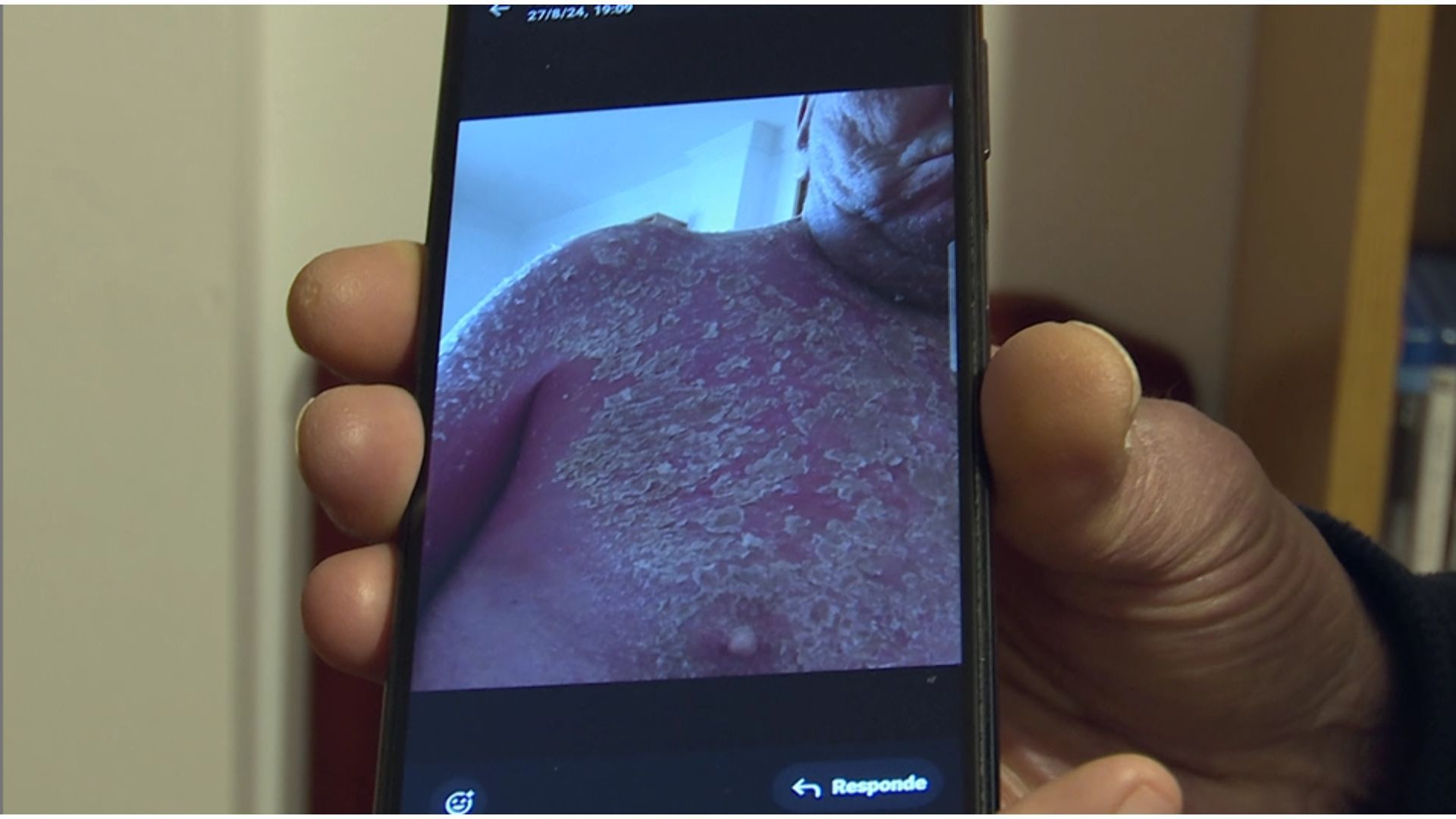 Un paciente con TOC de orden y simetría revela a 'Callejeros' las consecuencias ocultas: "Duele muchísimo" Un paciente con TOC de orden y simetría revela a 'Callejeros' las consecuencias ocultas: "Duele muchísimo"