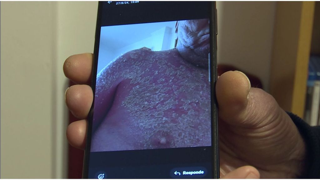 Un paciente con TOC de orden y simetría revela a 'Callejeros' las consecuencias ocultas: "Duele muchísimo"