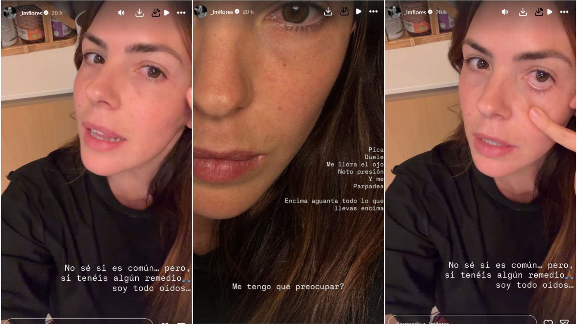 Laura Matamoros ha mostrado el problema ocular que tiene por motivos de estrés