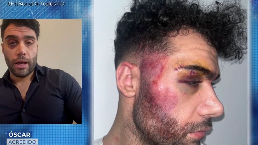 Un camarero recibe una brutal paliza por parte de unos clientes: ''Las chicas empezaron a darme puñetazos en la nuca''