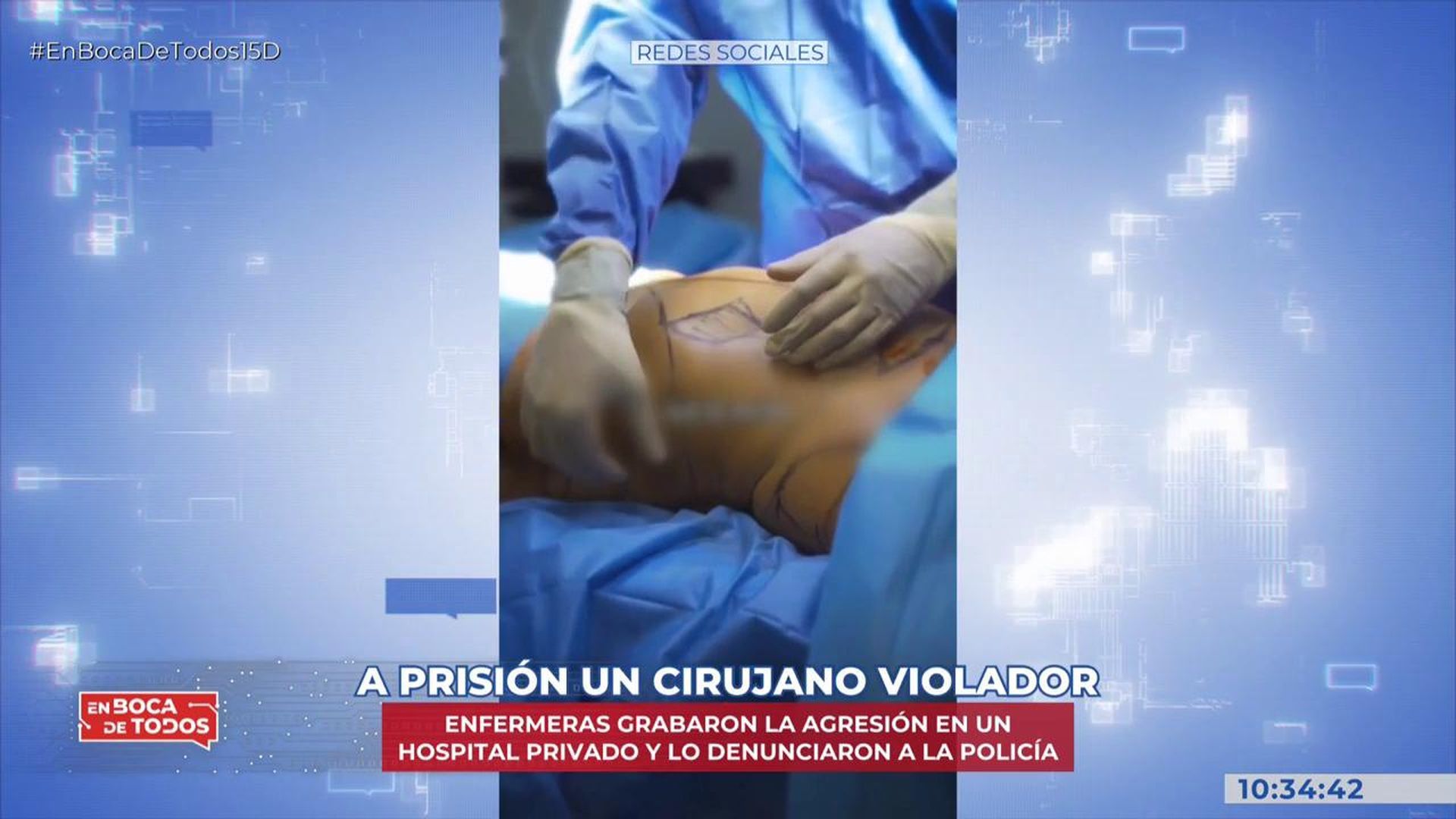 Detienen a un cirujano plástico por la presunta violación de una paciente sedada para uno operación de aumento de pecho Detienen a un cirujano plástico por la presunta violación de una paciente sedada para uno operación de aumento de pecho