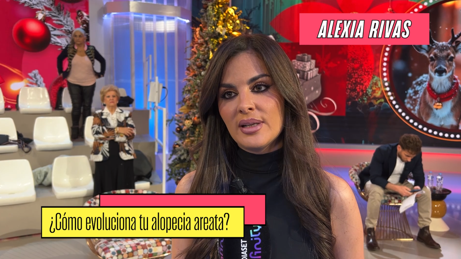Alexia Rivas actualiza cómo evoluciona su alopecia areata: "Lo sufre un 5% de la población"