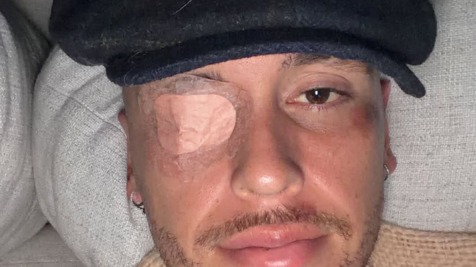 Lucas Ocampos sufre una parálisis facial