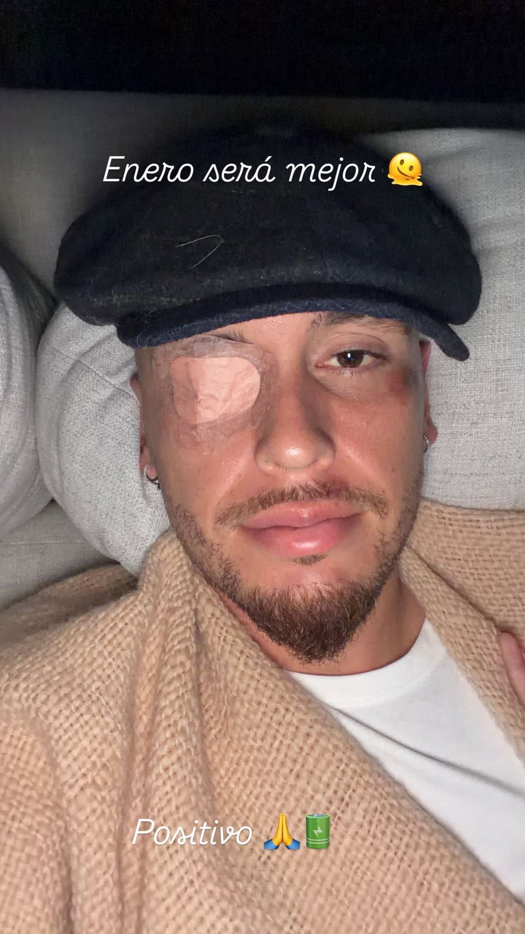 Lucas Ocampos sufre una parálisis facial