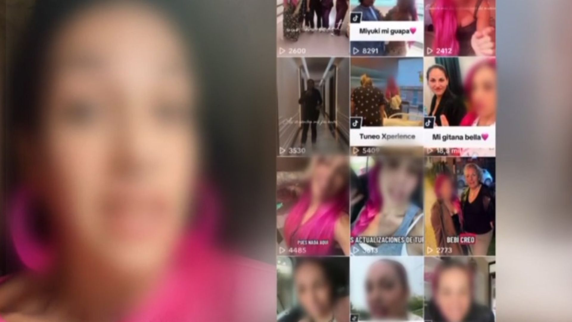 Las recomendaciones para realizarse operaciones estéticas en Turquía