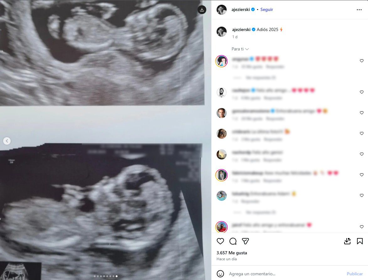 Adam Jezierski comparte la ecografía de su bebé
