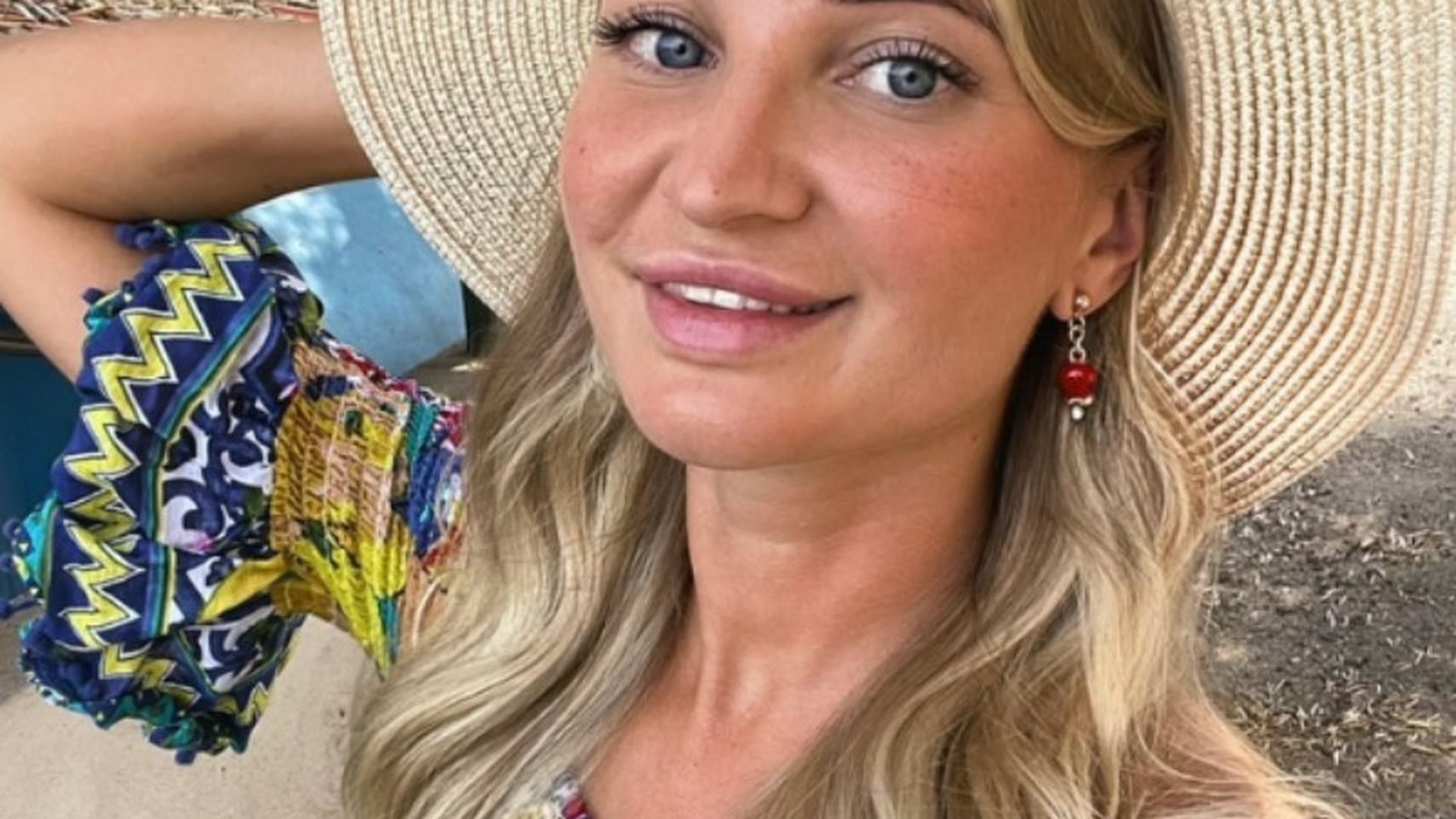 Yulia Burtseva falleció en Moscú tras someterse a una intervención estética en clínica privada