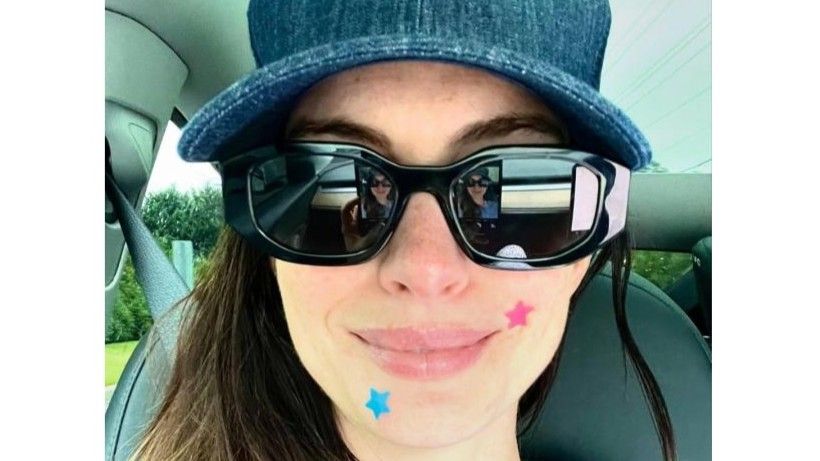 Anne Hathaway con parches para granos. FUENTE: Instagram @annehathaway