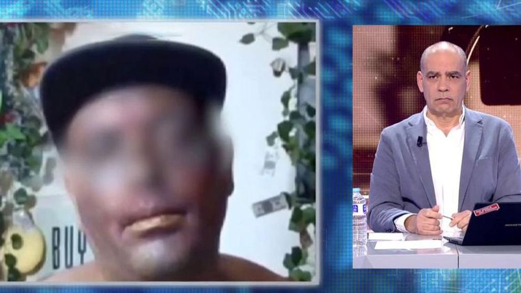 Nacho Abad, muy crítico con los 'psicópatas digitales'