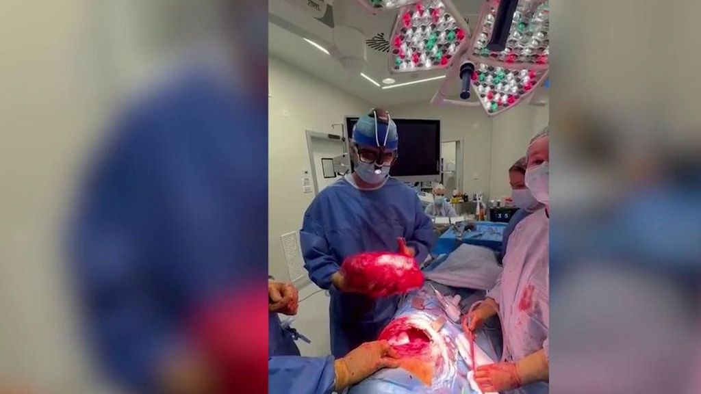 El cirujano Diego González Rivas extirpa un tumor de 4 kilos a Elisabeth en una operación imposible