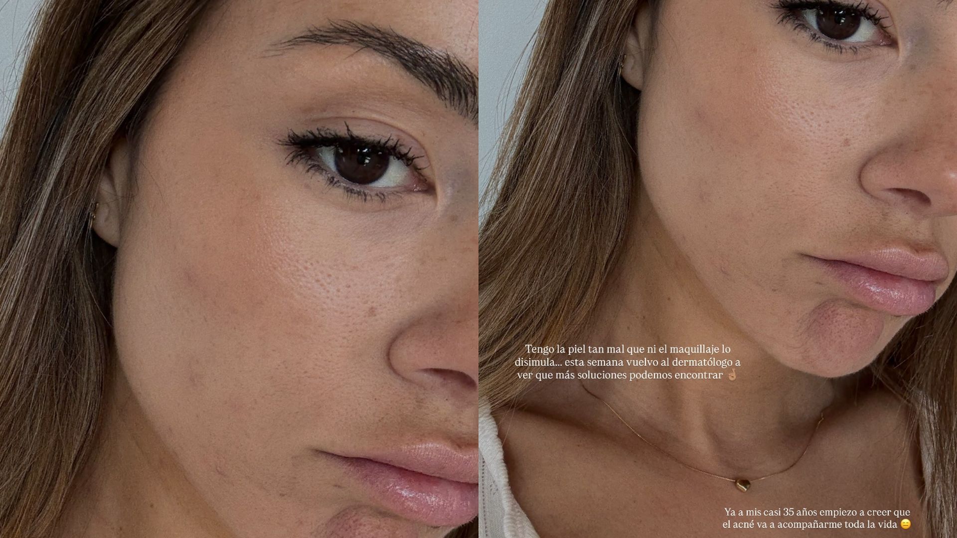 Melyssa Pinto se sincera sobre el problema que sufre: "A mis 35 años empiezo a creer que va a acompañarme toda la vida"