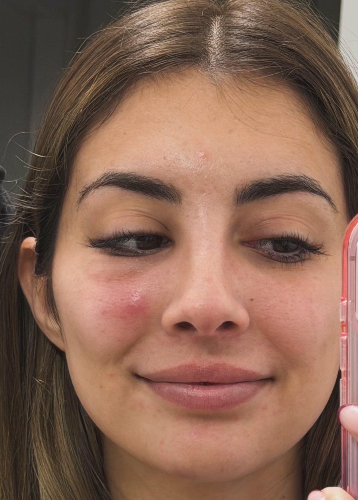 Marieta cara hinchada