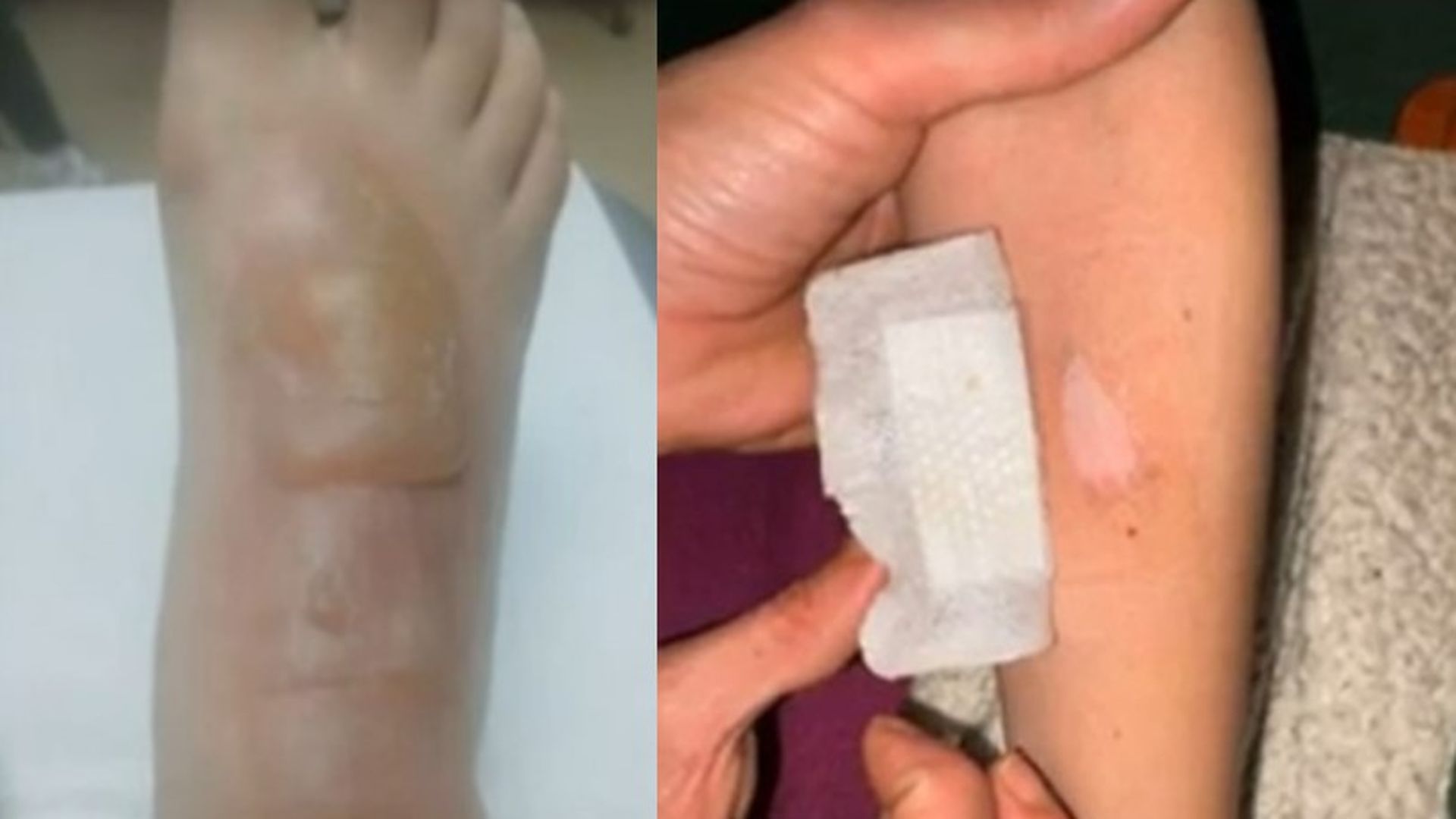 Las lesiones que presentaba el menor agredido por un compañero de clase en Cádiz