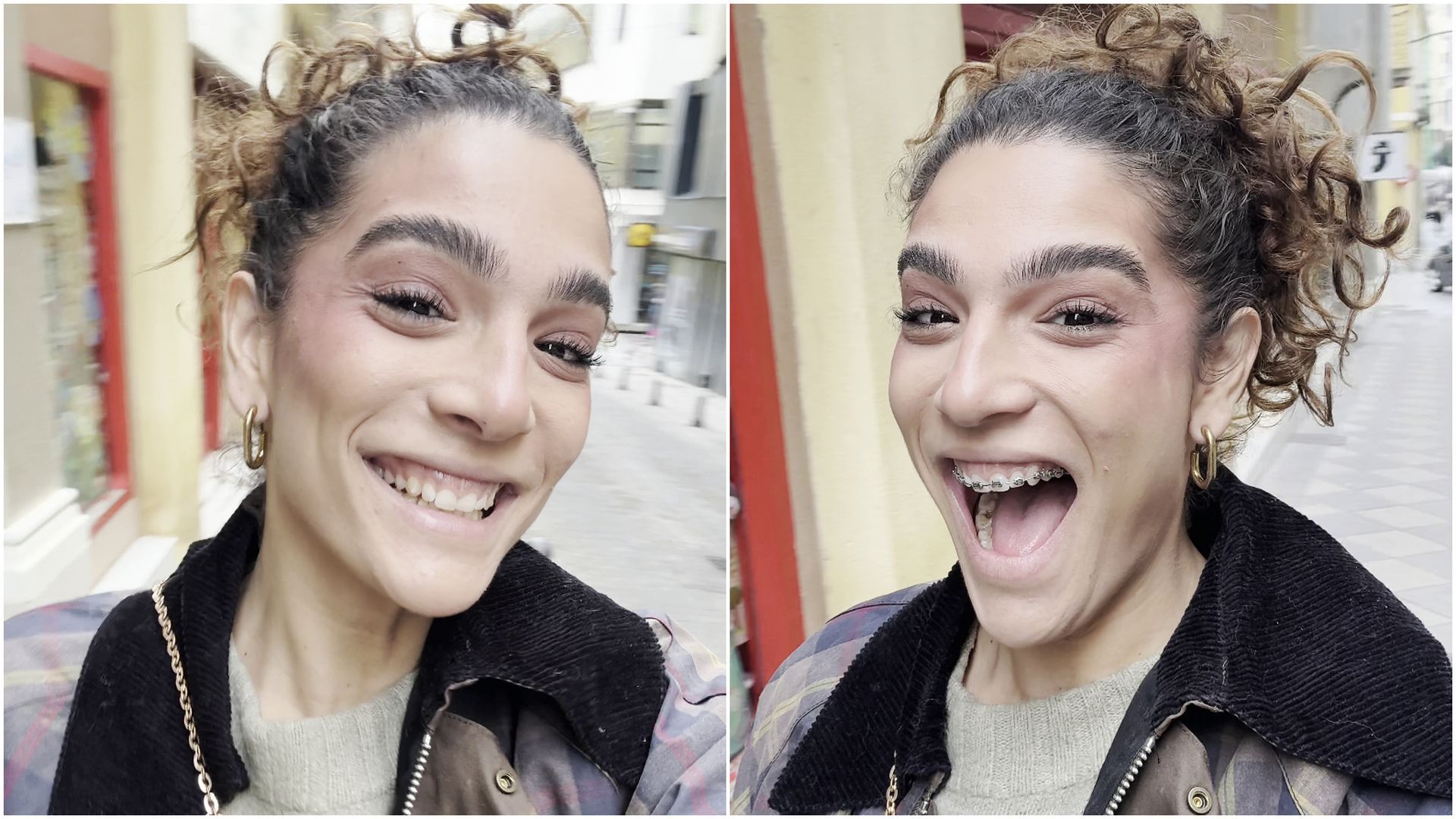 Alma Bollo da un importe paso y se pone aparatos en los dientes