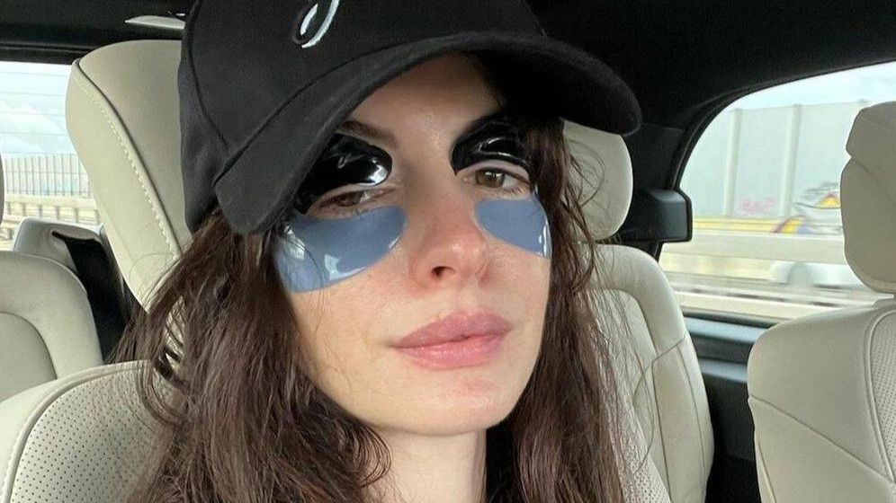 La actriz Anne Hathaway con parches en los ojos. FUENTE: Instagram/@annehathaway