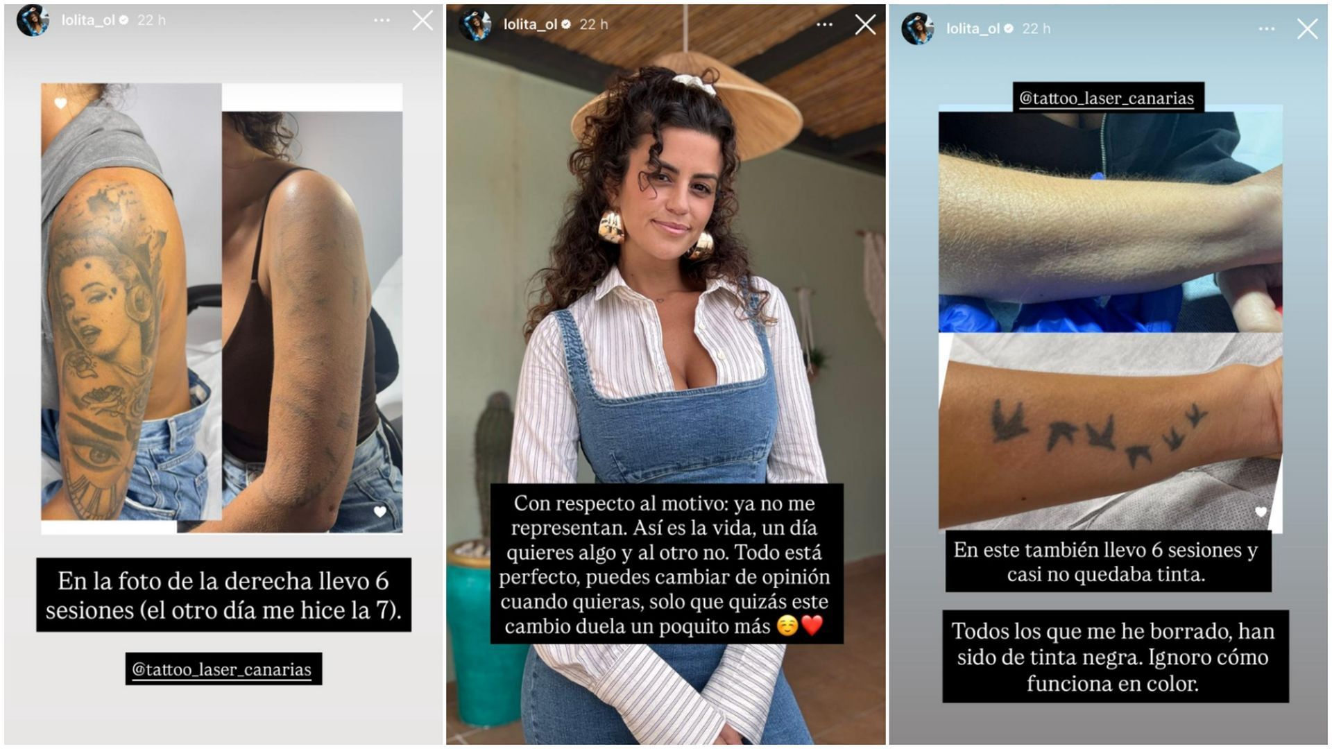 Lola Ortiz muestra los tatuajes que se ha borrado de su cuerpo y explica el motivo