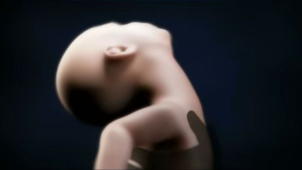 Las consecuencias del síndrome del bebé zarandeado: “Es muy habitual que haya fracturas en brazos, piernas o huesos del cráneo”