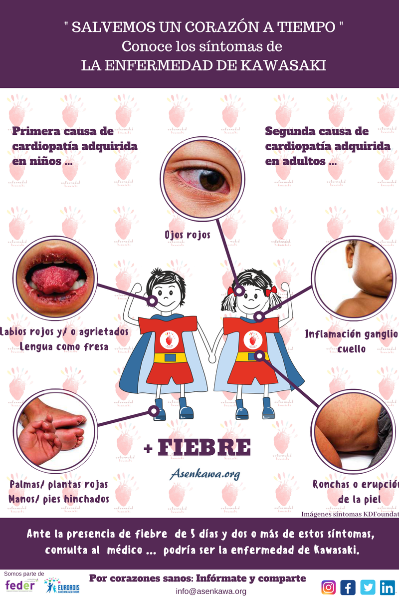 Síntomas enfermedad de Kawasaki