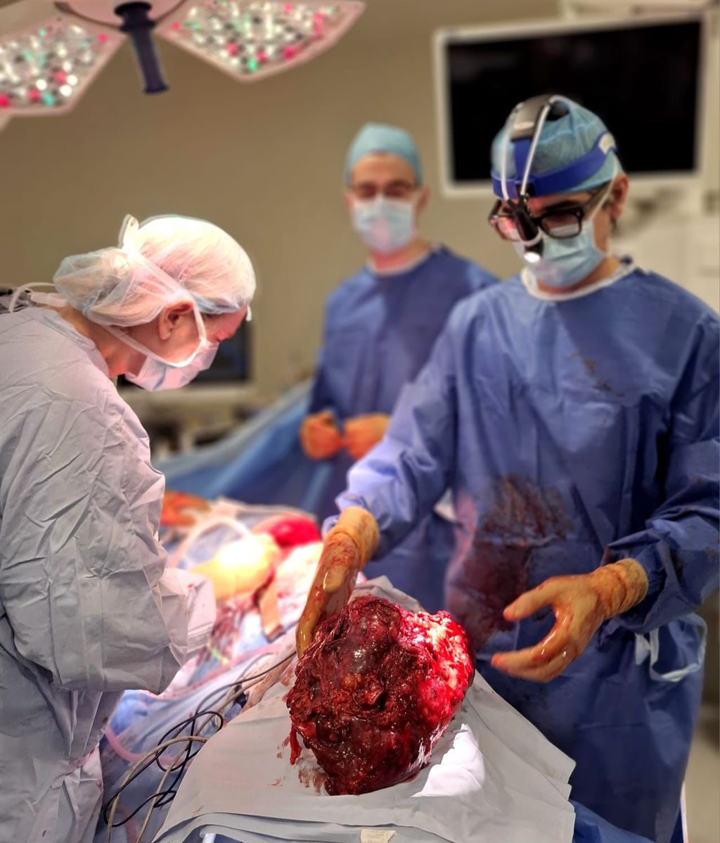 Un momento de la operación de casi cinco horas para extirpar un tumor de cuatro kilos
