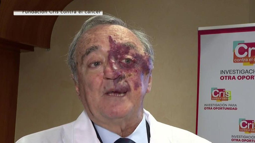 Barbacid y su equipo logran eliminar por completo tumores de páncreas en ratones utilizando una triple terapia