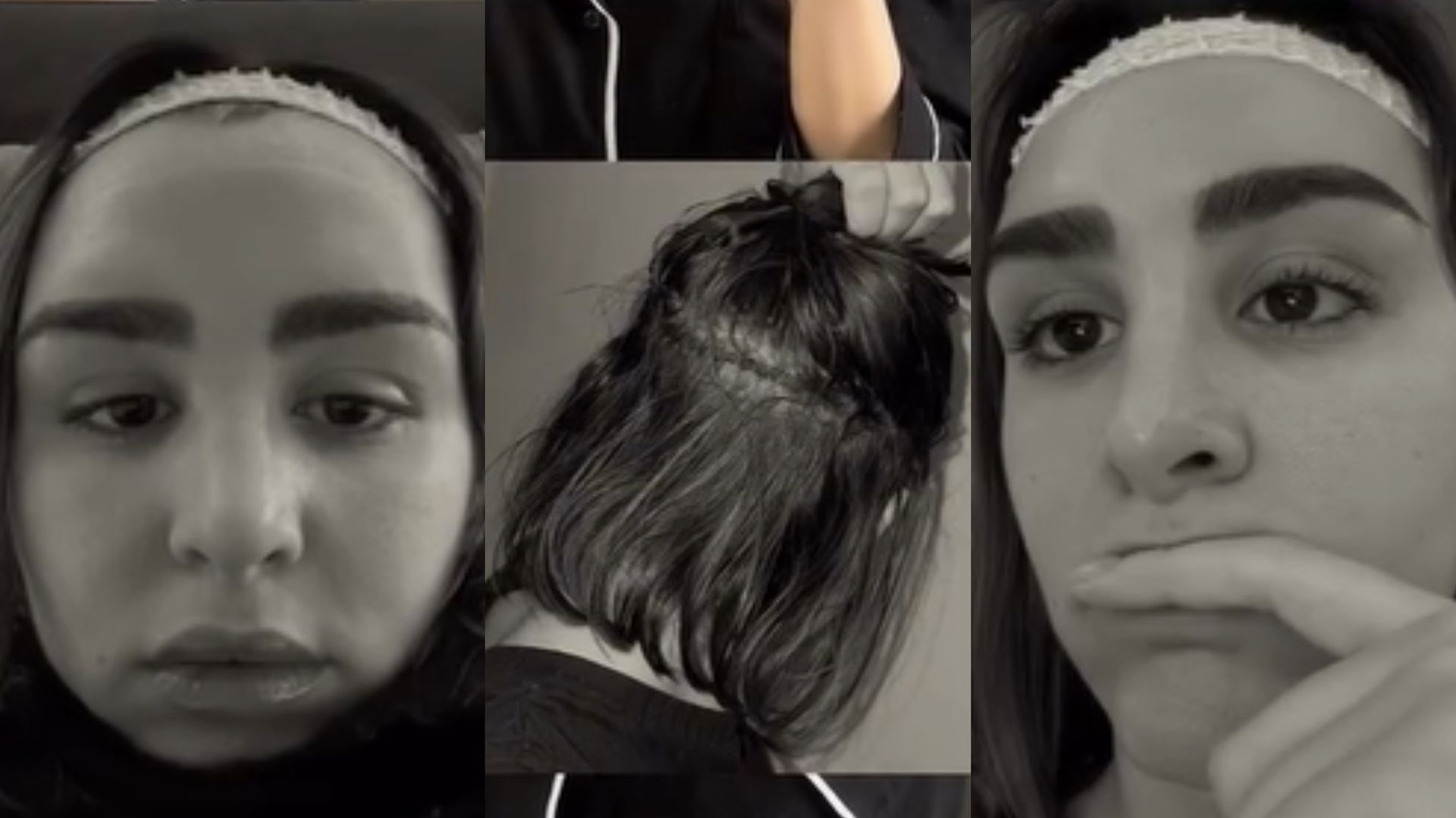 El resultado final del injerto de cejas de Marina García: "Es un proceso duro, os podéis arrepentir"