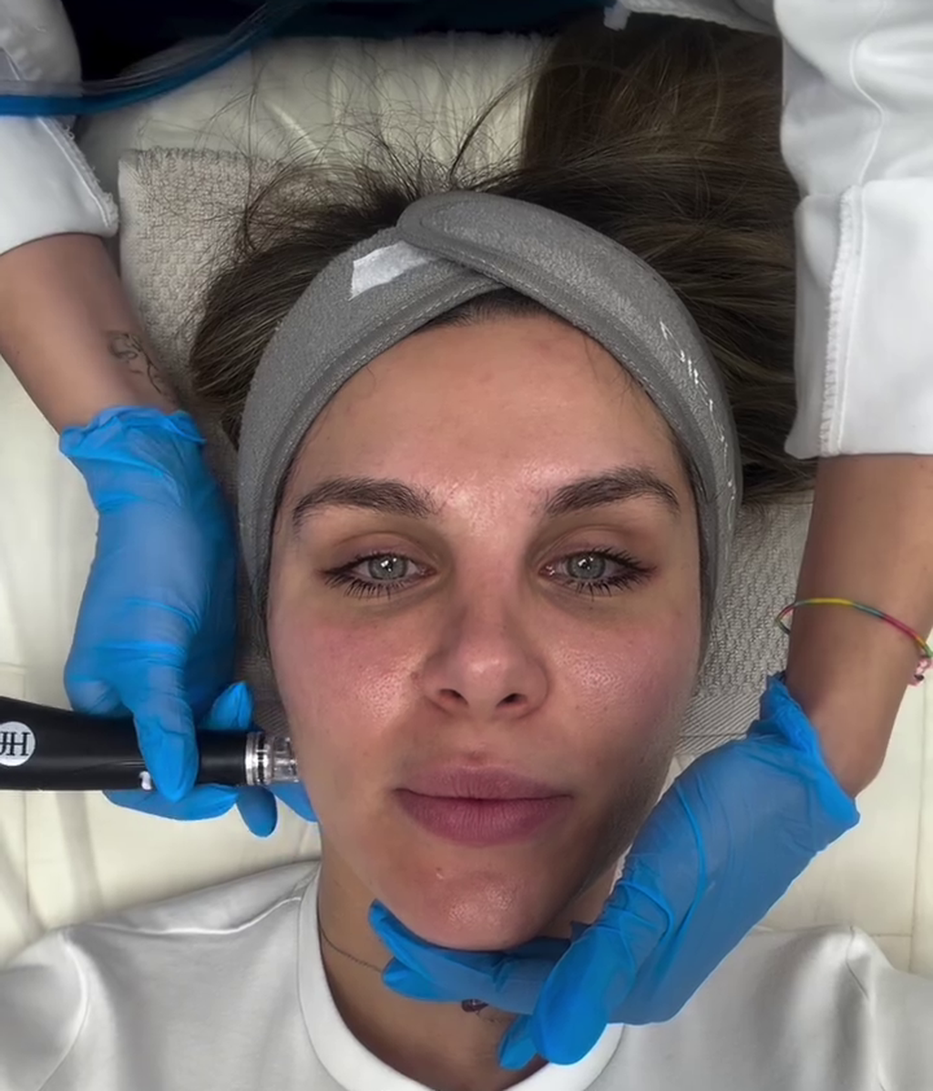Ivana Icardi haciendose un hydrafacil