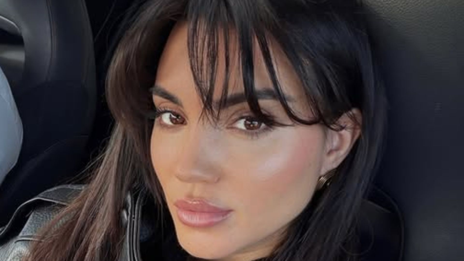 Melodie Peñalver muestra las graves secuelas que le dejaron en un procedimiento estético: "Se me hizo un queloide"