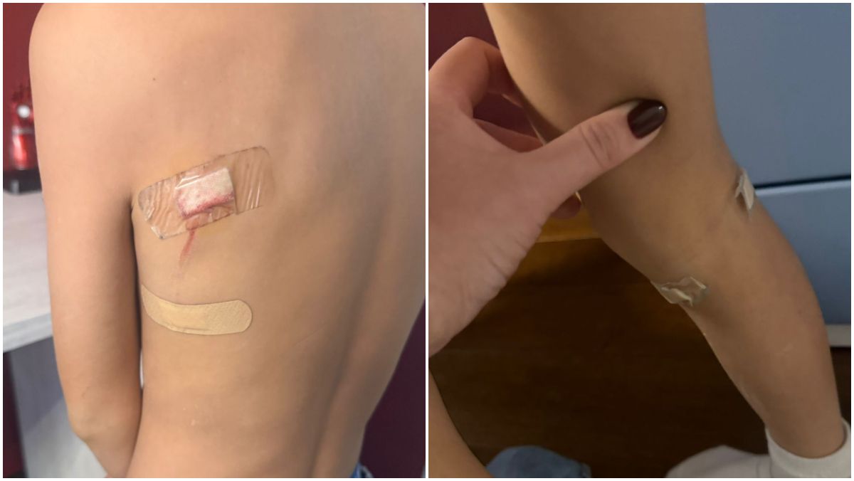 Heridas que el animal le provocó al pequeño de 9 años