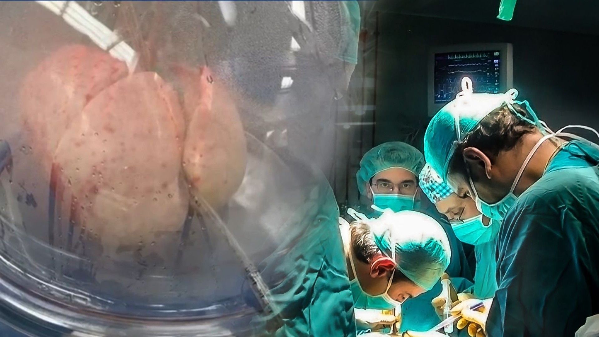 la-recuperacion-de-un-pulmon-16-9-aspect-ratio-default-0_da39